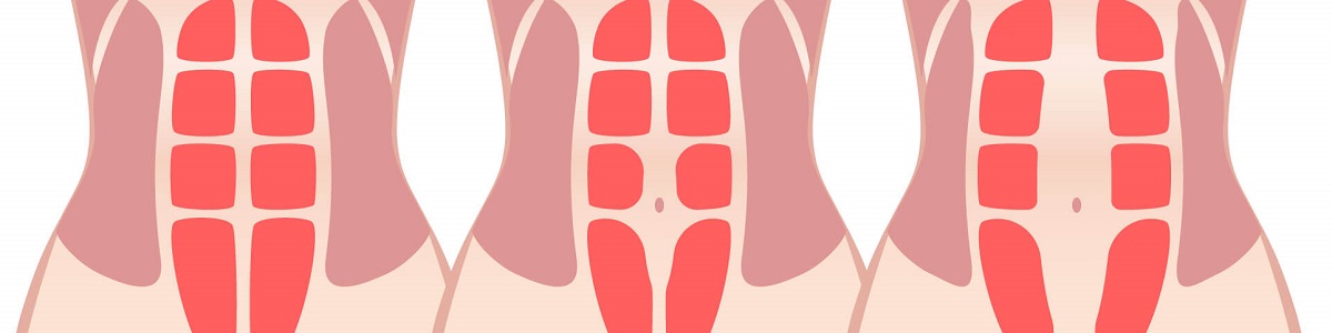 Webinar en Tratamiento de la Diástasis Abdominal Post Parto