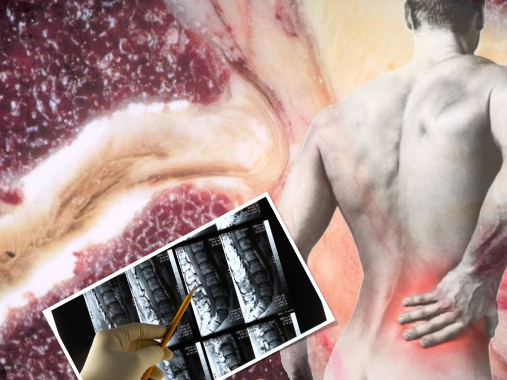 Rutinas para bajar de peso y marcar musculoskeletal injuries Rutinas para bajar de peso y marcar musculoskeletal injuries