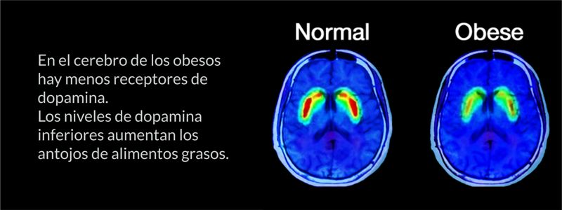 Causas de obesidad y sobrepeso pdf Causas de obesidad y sobrepeso pdf
