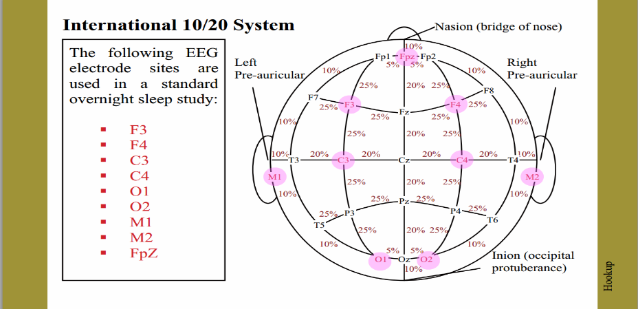 10-20-eeg-conectarse