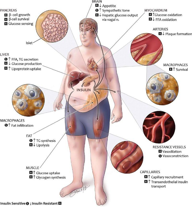Fisiopatología de la obesidad: Perspectiva actual Fisiopatología de la obesidad: Perspectiva actual