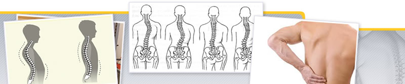 Taller de Ejercicio en Patologías y Alteraciones de la Columna Vertebral