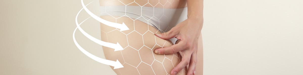 Webinar sobre el Rol del Ejercicio Físico en el Tratamiento de la Celulitis