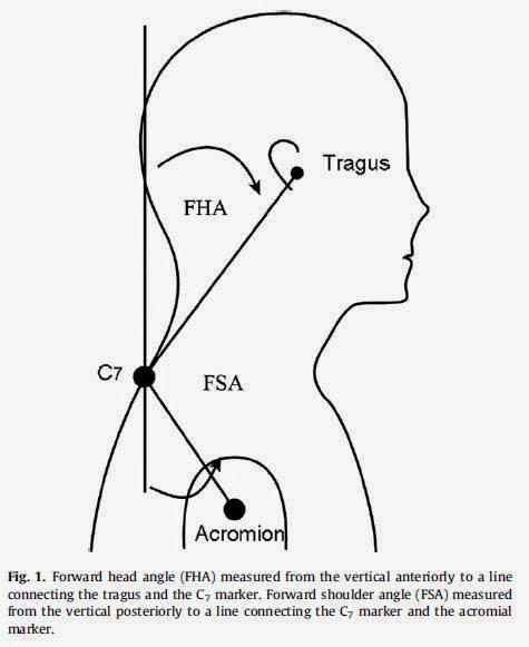 Imagen 5. Medición de la protracción de cabeza y hombros (Thigpen et al., 2010). Extraída del blog Temadeporte de Ignacio González Za